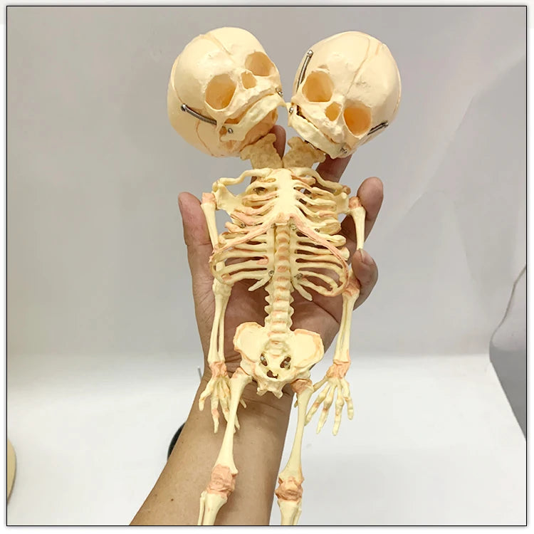 Two-Headed Fetal Skeleton Model