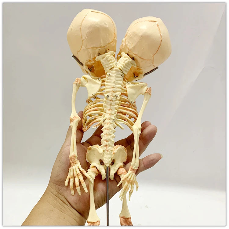 Two-Headed Fetal Skeleton Model