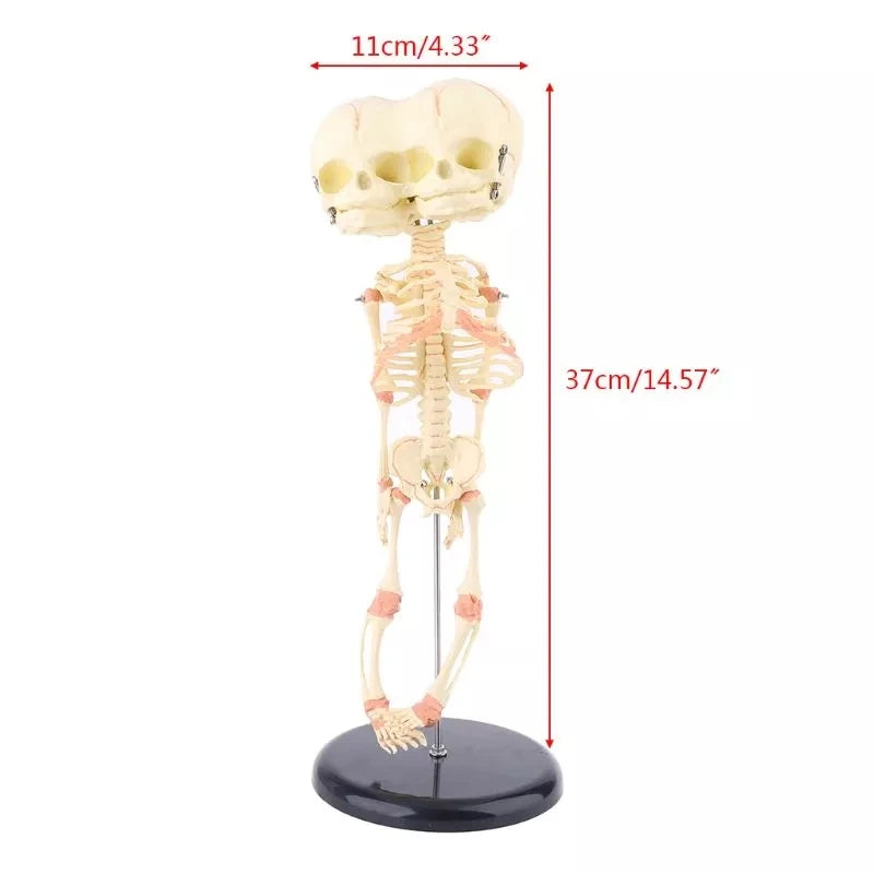 Two-Headed Fetal Skeleton Model