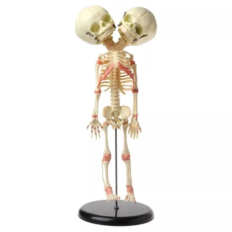 Two-Headed Fetal Skeleton Model
