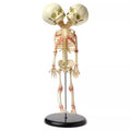 Two-Headed Fetal Skeleton Model